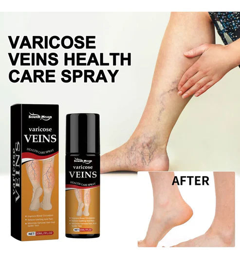 SmartHeal™ VARICOSE VEINS RELIEF SPRAY (BUY 1 GET 1 FREE)