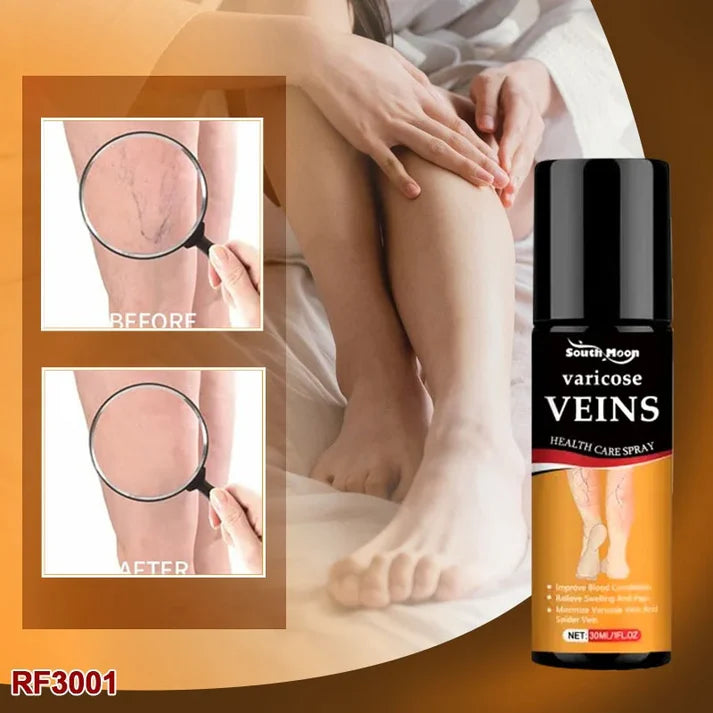 SmartHeal™ VARICOSE VEINS RELIEF SPRAY (BUY 1 GET 1 FREE)