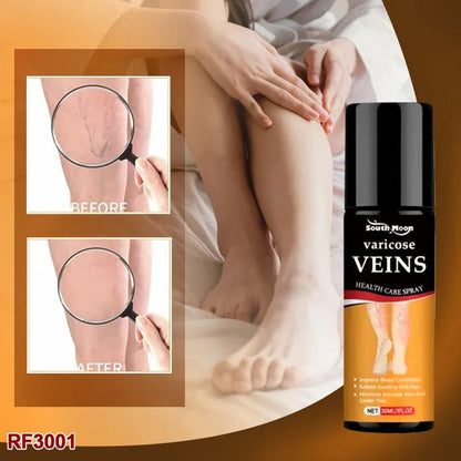SmartHeal™ VARICOSE VEINS RELIEF SPRAY (BUY 1 GET 1 FREE)