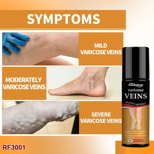 SmartHeal™ VARICOSE VEINS RELIEF SPRAY (BUY 1 GET 1 FREE)